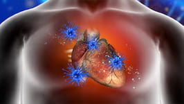 Heart Disease in Women